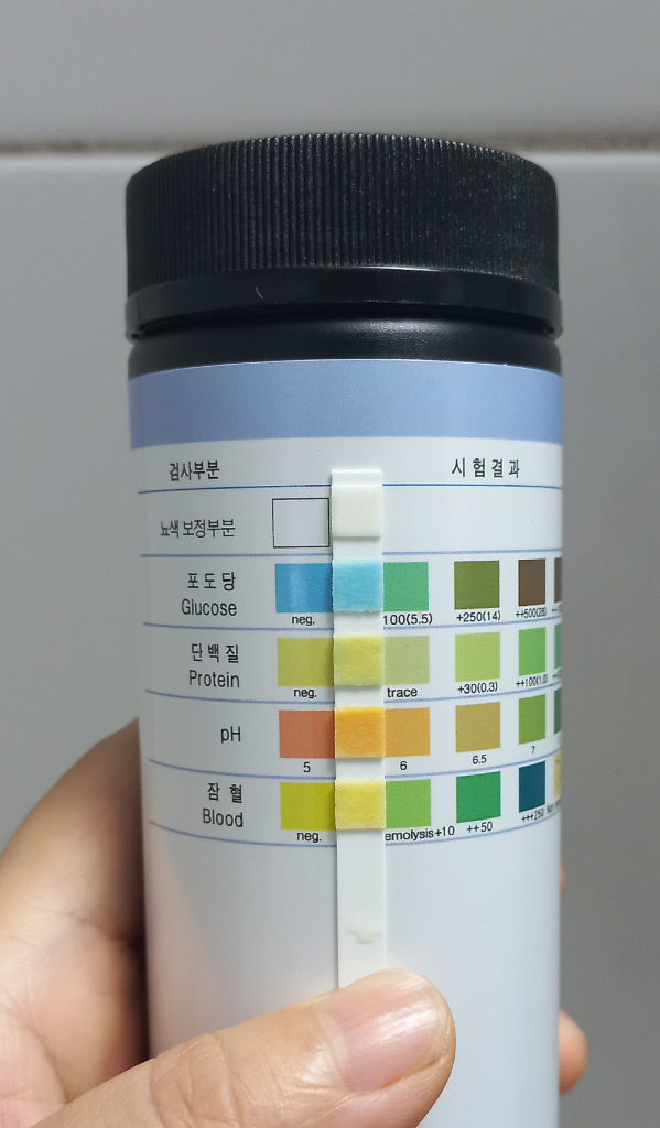 아침 첫소변으로 한 단백뇨 스틱검사 음성일까요? | 궁금할 땐, 아하!
