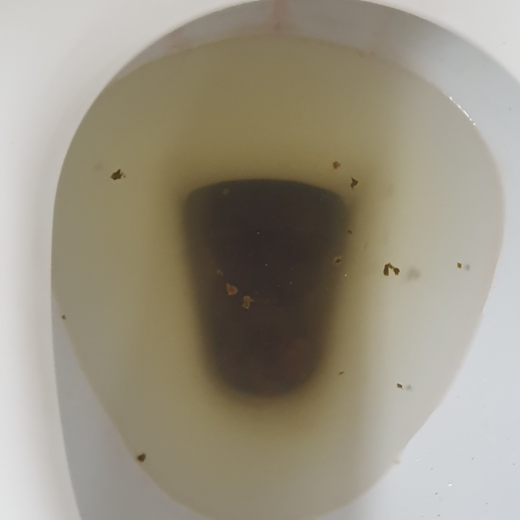 (사진ㅇ) 최근 복통없는 묽은변 또는 설사 대변상태 확인해주세요 ㅣ 궁금할 땐, 아하!