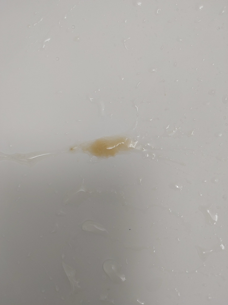 아침마다 누런 가래가 나옵니다 왜 이런 걸까요? ㅣ 궁금할 땐, 아하!